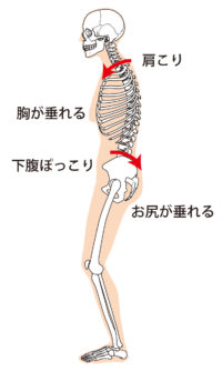 O脚 骨盤後傾の影響 姿勢