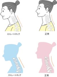 背中の硬さ、痛みを予防する体操